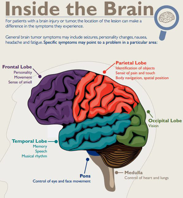 Basics of Brain Tumors | Johns Hopkins Medicine Health Library