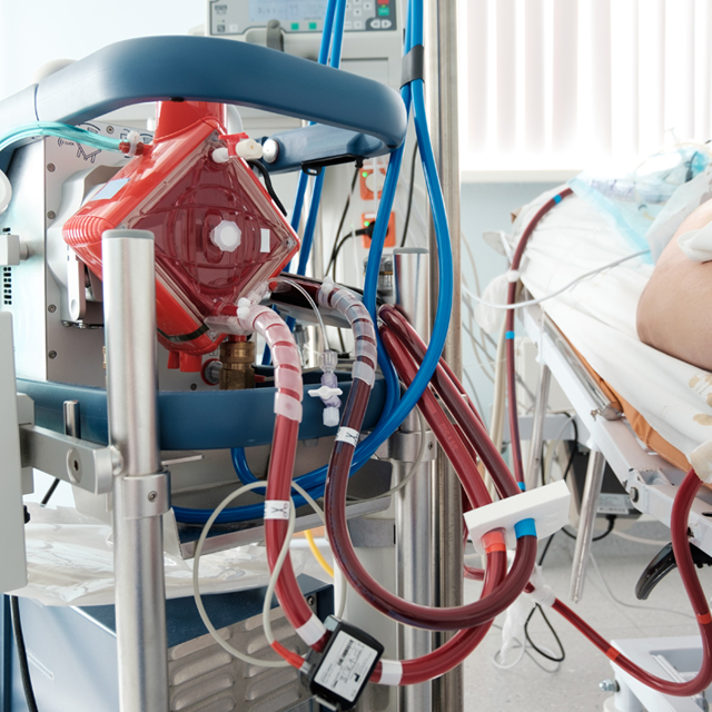 ECMO Team Approach Improves Odds For Critically Ill Patients