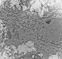 an untreated neural cell shows no vacuoles