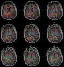 Radiology Exam: | Johns Hopkins Radiology