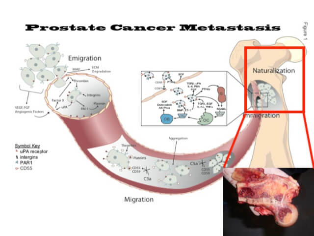 Pienta Lab The Tumor Ecosystem Cancer As An Invasive Species Johns